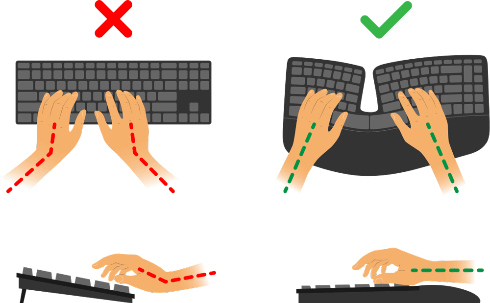 Vergleich klassische und ergonomische Tastatur